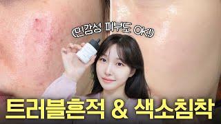 cc) The king of home care! The real way to easily remove acne marks and pigmentation..ㅣArang