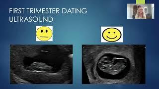 Biometry Matters! | Monica Kelly | Advanced Fetal Imaging Conference