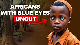 Africans with Blue Eyes | Rarest Eye Colors in Africans