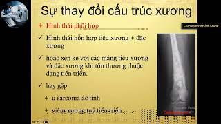 U Xương | Thầy Nguyễn Duy Hùng
