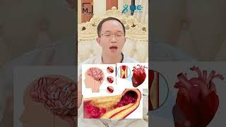Vì sao người gầy vẫn bị Mỡ Máu Cao | Bác Sĩ Trần Minh #short #shorts #bacsitranminh