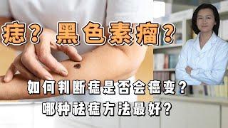 Moles or Cancer? What is the best way to remove moles?如何判断痣是否会癌变？哪种祛痣方法最好？