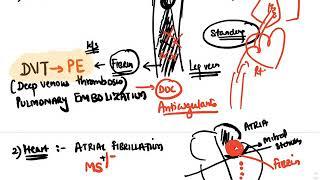 Hematology : Anti-Coagulants