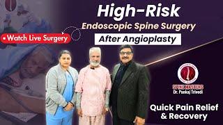 High-Risk Endoscopic Spine Surgery After Angioplasty | Quick Pain Relief & Recovery | Spine Masters