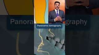 Everything You need to Know about Wisdom Tooth Extraction ~ Implant Smiles  #hyderabaddentist