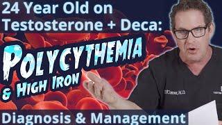 Polycythemia - 24 y.o. Man on Deca-Durabolin & Testosterone - Diagnosis & Management