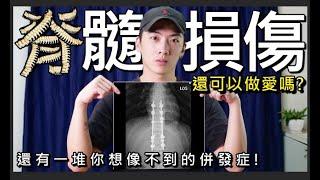 坐輪椅後還可不可以做愛？後遺症？你所不知道的脊髓損傷(Spinal Cord Injury)！ ｜chairman椅人