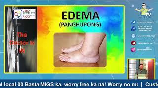 The DOCTOR is IN: EDEMA (Panghupong)