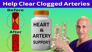 This Pill a Day Helps Clear Your Arteries Away!  Dr. Mandell