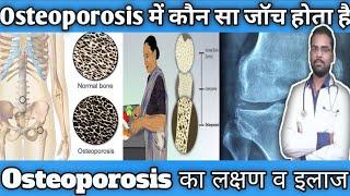 Osteoporosis का इलाज | Osteoporosis का शुरूआती लक्षण |Osteoporosis ka gharelu ilaj in Hindi |