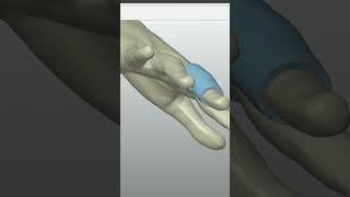 QUICKSURFACE's Medical Uses #cad  #3dreverseengineering