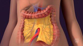 Mayo Clinic Minute: Prepare for colon cancer screening with confidence