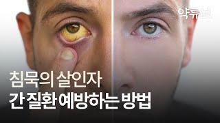 간 영양제 전통강자 밀크씨슬 VS 최신성분! 늦기전에 꼭 알아야 하는 간건강 지키는 방법! 약사가 알려드려요