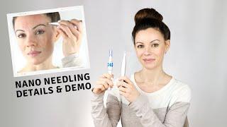 Nano Needling vs Microneedling | Demo & Details