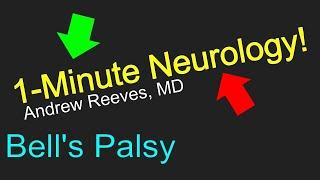 1-Minute Neurology: Bell's Palsy