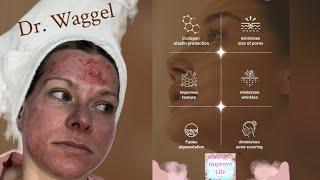 Watch Dr. Waggel Try Microneedling!