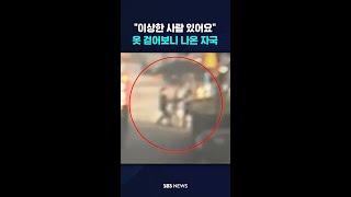 "이상한 사람 있어요!" 옷 걷어보니 나온 자국 #shorts