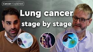 What happens in every stage of lung cancer? | Cancer: Explained | Macmillan Cancer Support