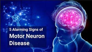 Motor Neuron Disease | 5 Alarming Signs of Motor Neuron Disease