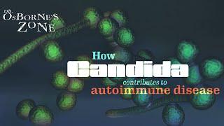 How Candida Contributes to Autoimmune Disease - Dr. Osborne's Zone