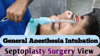 General Anesthesia Intubation Procedure | Septoplasty Surgery View  | Anesthetic Waseem