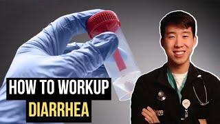 How To Evaluate And Treat Diarrhea (Easy Guide)