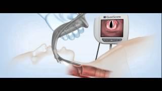 GlideScope Titanium Video Laryngoscopes Demonstration