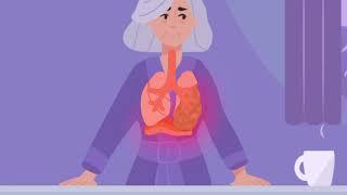 Understanding Severe COPD/Emphysema and if the Zephyr Valve Treatment Could Help You