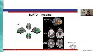 AFTD Care Partner Learning Series Webinar: Navigating Behavioral Variant FTD Symptoms