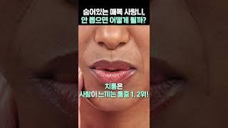 숨어있는 매복 사랑니, 안 뽑으면 어떻게 될까?