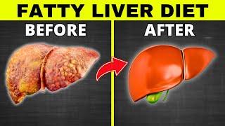 Fatty Liver Diet (5 BEST Foods and 5 To DITCH) Meal Plan