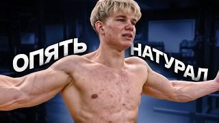 у Натурала Подростковые Прыщи в 19 Лет / Максим Беленко