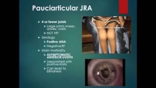 2016: Choosing Wisely: Recommendations for in Rheumatology Patients