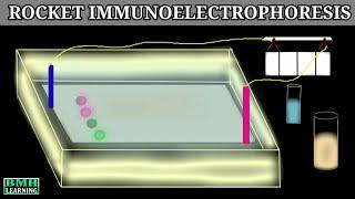 Rocket Immunoelectrophoresis | Immunoelectrophoresis |