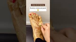 Get Fair Feet In 5minutes | Most Easy Pedicure | Remove Suntan Easily At Home #pedicure #shorts #diy