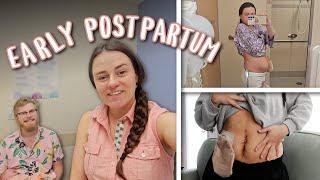 The First Few Weeks Postpartum | Belly Update and Learning Boundaries | Let's Talk IBD
