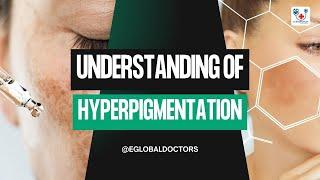 Understanding Hyperpigmentation Solutions | eGlobalDoctors