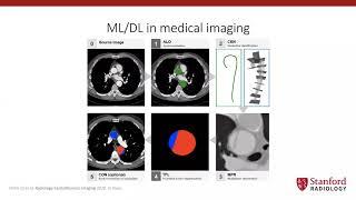 Webinar 31 Preparing medical imaging data for machine learning by Martin Willemink