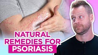 How to Get Rid of Psoriasis – Natural Remedies for Psoriasis