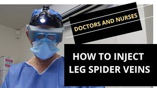 Microsclerotherapy Guide for HealthCare Professionals: How to Inject Leg Spider Veins