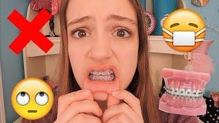 Things People With Braces Will Understand