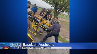 Loveland Boy Receives 500 Stitches After Colliding With Fence