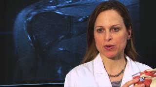 Dr. Sabrina Strickland explains Rotator Cuff Repair