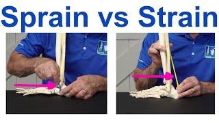 Sprain vs Strain: Understanding the Key Differences