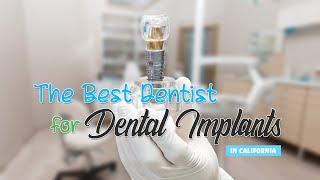 Best Dentist for Dental Implants in California