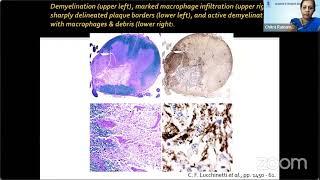 AIOS ARC Diagnosing the... DR. ANDREW G LEE