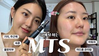 피부미용학과 교수님이 알려주는 MTS 🩶 (feat. 피부광, 속광) / 속당김 제로로 만들어주기 / 피부관리 꿀팁 총집합 / 셀프mts / 스페셜홈케어