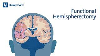 Functional Hemispherectomy | Duke Health