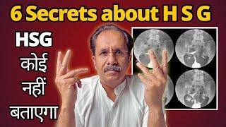 The shocking reality of hysterosalpingogram|Dr.Sunil Jindal|Jindal Hospital Meerut