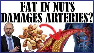 Does The Fat In Nuts Damage Our Arteries?